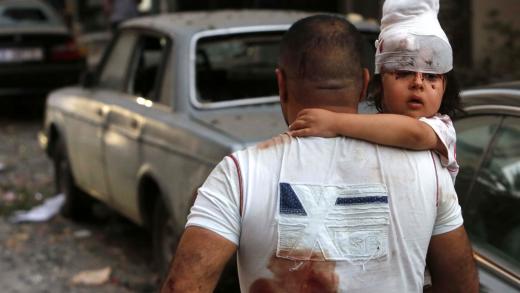 Gewond kind wordt gedragen door man in Beiroet, Libanon